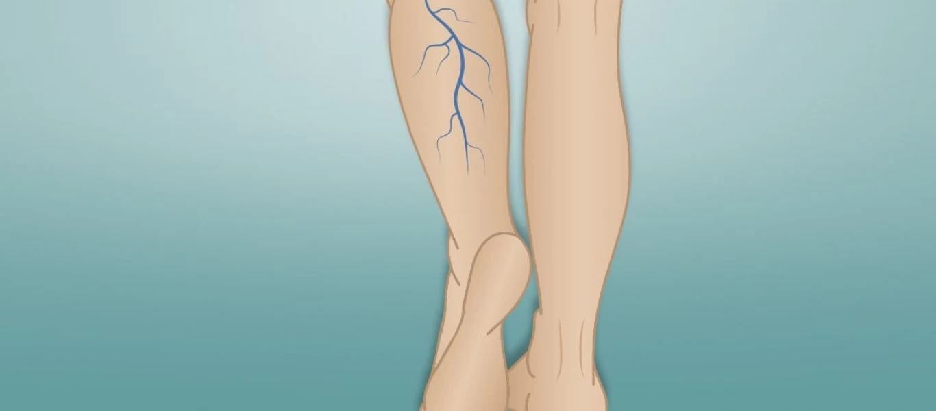 Αυτές είναι οι τροφές που προστατεύουν τις φλέβες & τις αρτηρίες